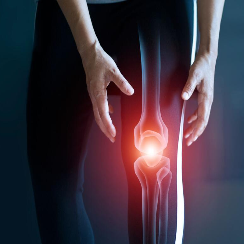 Artroz (Kireçlenme)