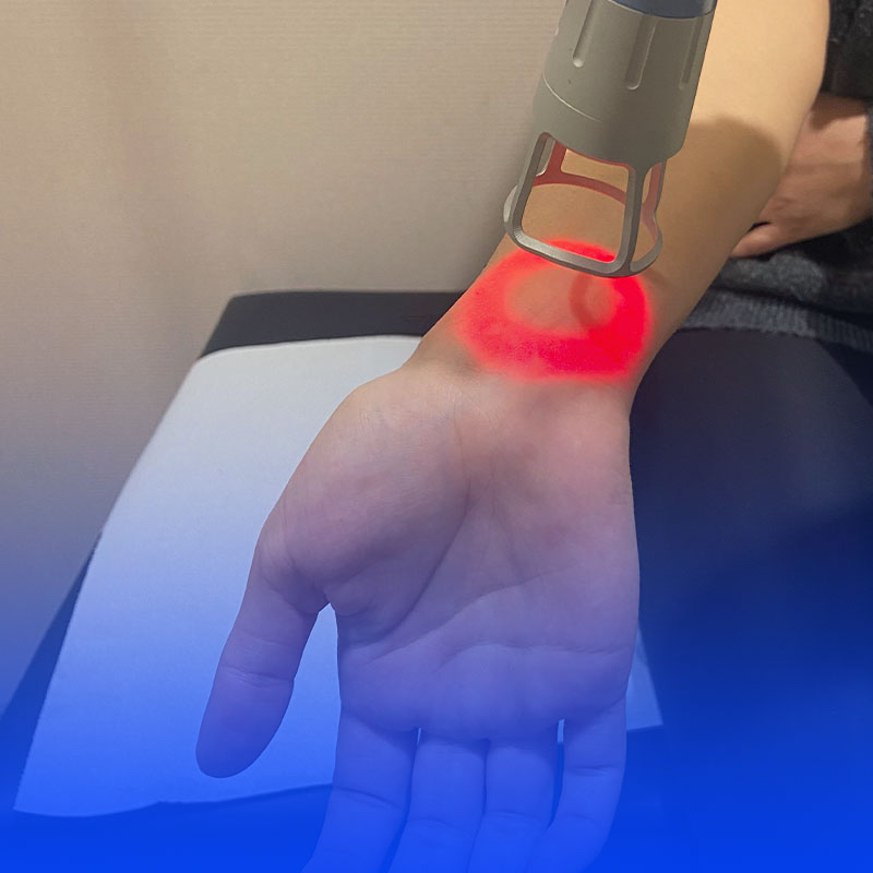 Karpal Tünel Sendromu 